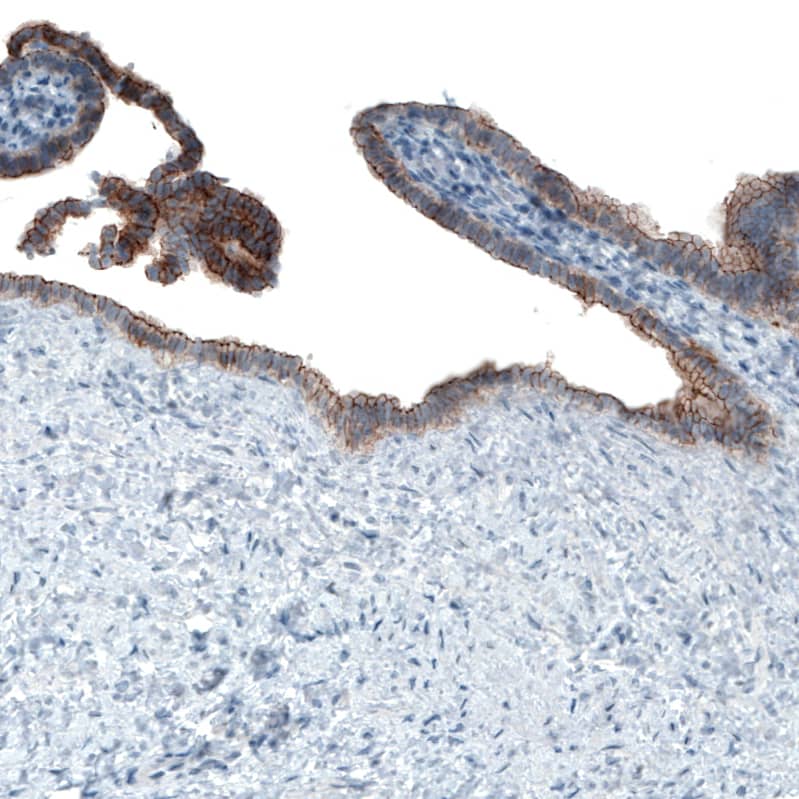 Occludin Antibody (CL1555) Immunohistochemistry: Occludin Antibody (CL1555) [NBP3-52053]