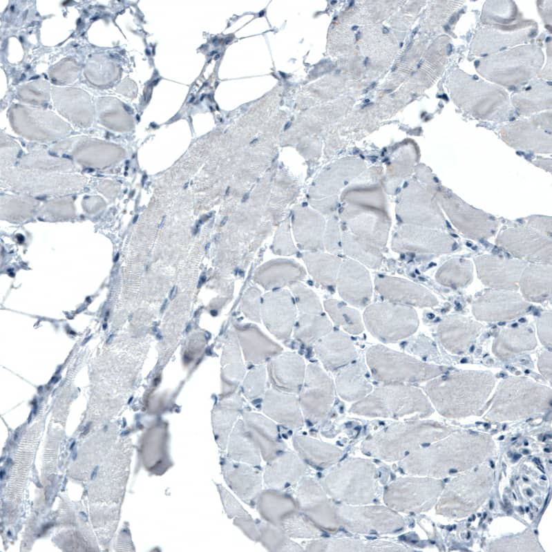 Occludin Antibody (CL1555) Immunohistochemistry: Occludin Antibody (CL1555) [NBP3-52053]