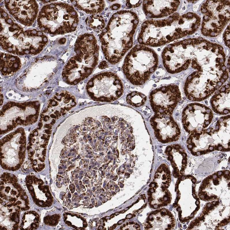 TUFM Antibody (CL2242) Immunohistochemistry: TUFM Antibody (CL2242) [NBP3-52054]