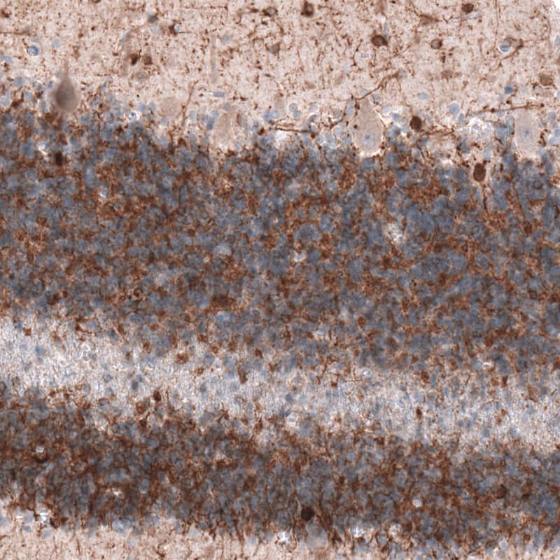 MAP2 Antibody (CL5420) Immunohistochemistry: MAP2 Antibody (CL5420) [NBP3-52055]