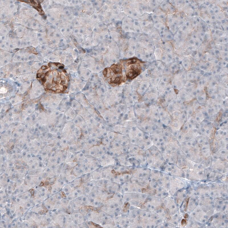 MAP2 Antibody (CL5420) Immunohistochemistry: MAP2 Antibody (CL5420) [NBP3-52055]