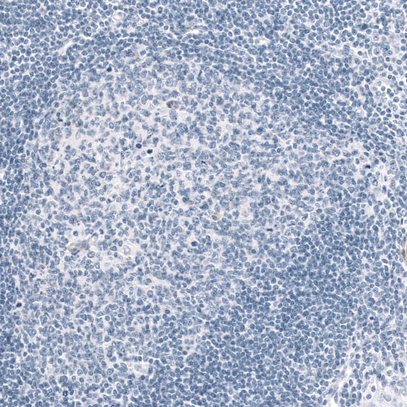 MAP2 Antibody (CL5420) Immunohistochemistry: MAP2 Antibody (CL5420) [NBP3-52055]