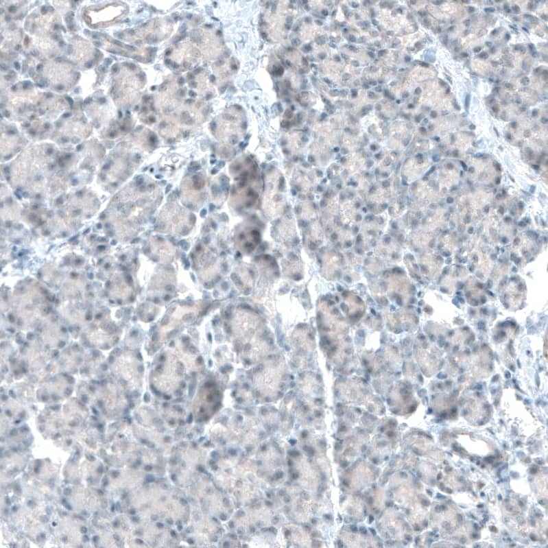 TET2 Antibody (CL6873) Immunohistochemistry: TET2 Antibody (CL6873) [NBP3-52056]
