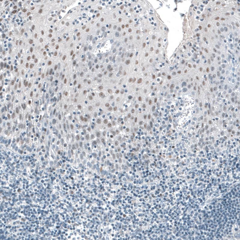 TET2 Antibody (CL6873) Immunohistochemistry: TET2 Antibody (CL6873) [NBP3-52056]