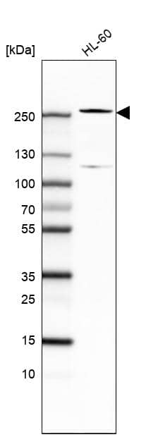 TET2 Antibody (CL6873) Western Blot: TET2 Antibody (CL6873) [NBP3-52056]
