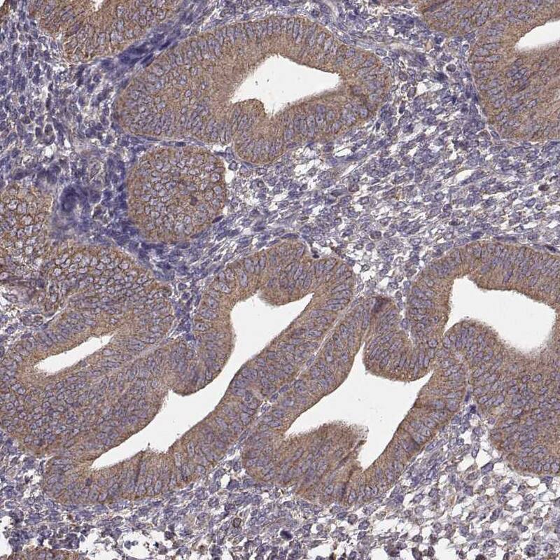 ERp57/PDIA3 Antibody (CL2444) Immunohistochemistry: ERp57/PDIA3 Antibody (CL2444) [NBP3-52057]