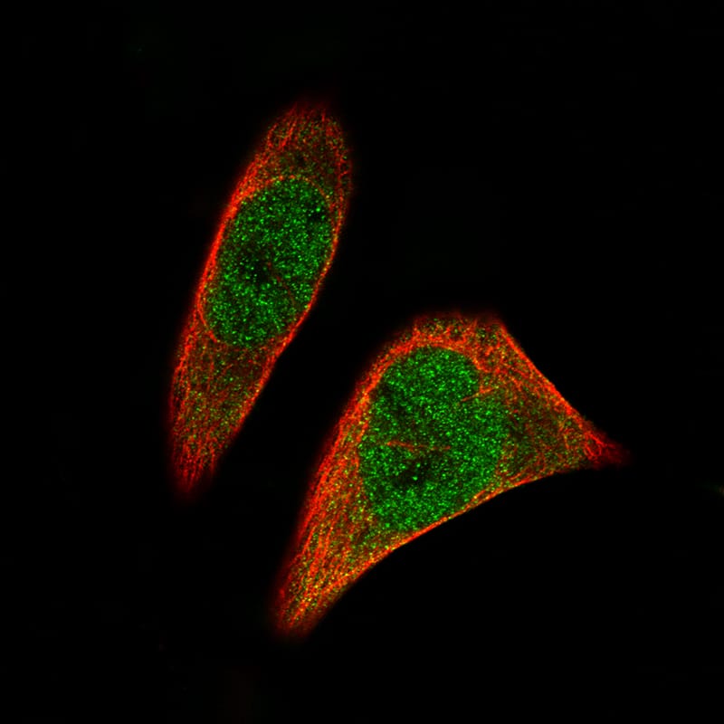 SOX11 Antibody (CL0142) Immunocytochemistry/ Immunofluorescence: SOX11 Antibody (CL0142) [NBP3-52058]