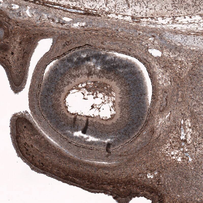 SOX11 Antibody (CL0142) Immunohistochemistry: SOX11 Antibody (CL0142) [NBP3-52058]