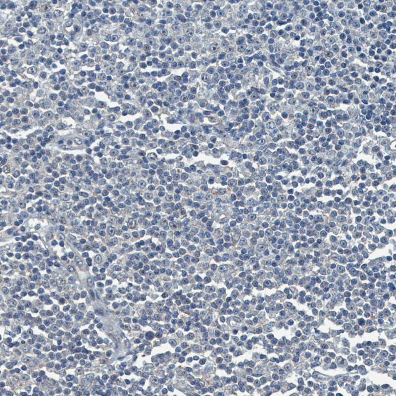 SOX11 Antibody (CL0142) Immunohistochemistry: SOX11 Antibody (CL0142) [NBP3-52058]