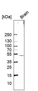 SOX11 Antibody (CL0142) Western Blot: SOX11 Antibody (CL0142) [NBP3-52058]