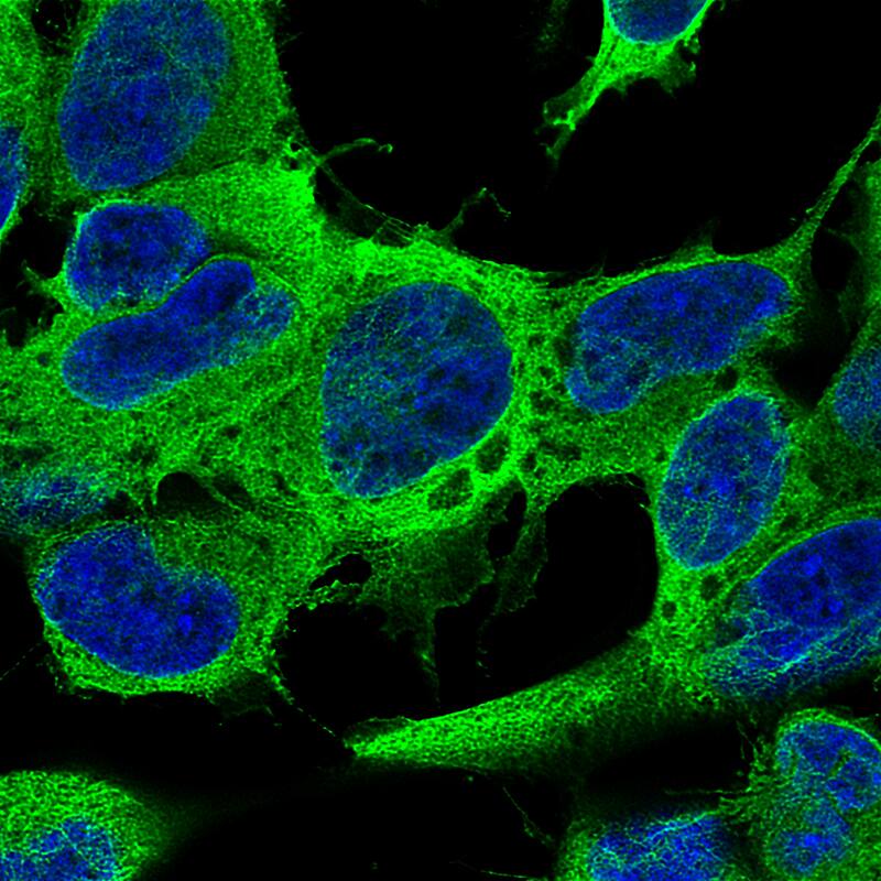 beta-III Tubulin Antibody (CL5813) Immunocytochemistry/ Immunofluorescence: beta-III Tubulin Antibody (CL5813) [NBP3-52481]