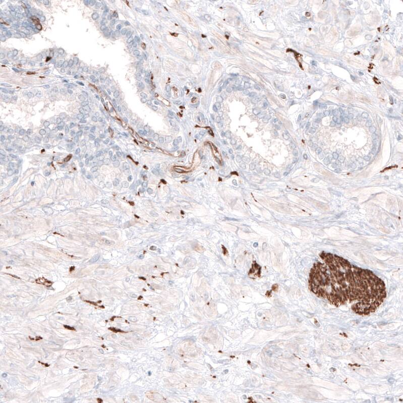beta-III Tubulin Antibody (CL5813) Immunohistochemistry: beta-III Tubulin Antibody (CL5813) [NBP3-52481]