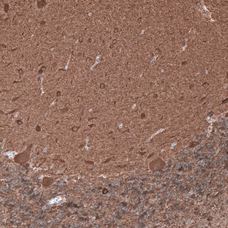 beta-III Tubulin Antibody (CL5813) Immunohistochemistry: beta-III Tubulin Antibody (CL5813) [NBP3-52059]