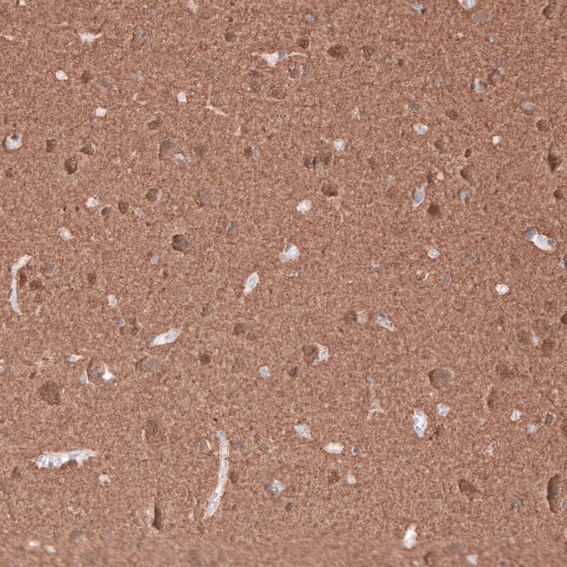 beta-III Tubulin Antibody (CL5813) Immunohistochemistry: beta-III Tubulin Antibody (CL5813) [NBP3-52059]