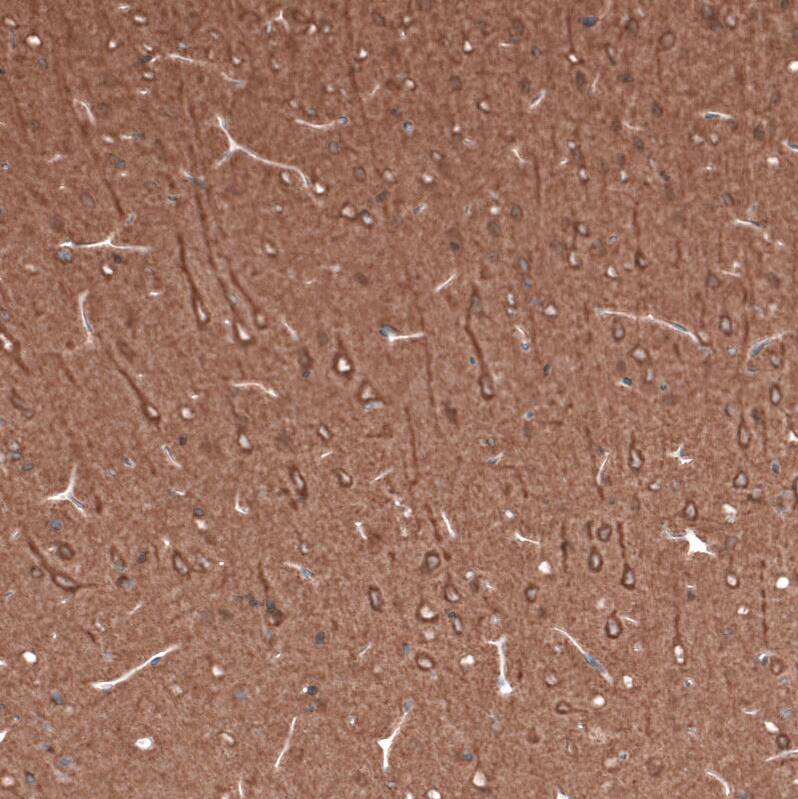 beta-III Tubulin Antibody (CL5813) Immunohistochemistry: beta-III Tubulin Antibody (CL5813) [NBP3-52059]