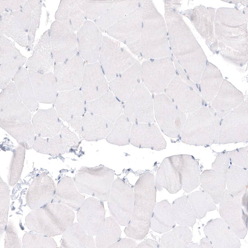 beta-III Tubulin Antibody (CL5813) Immunohistochemistry: beta-III Tubulin Antibody (CL5813) [NBP3-52059]