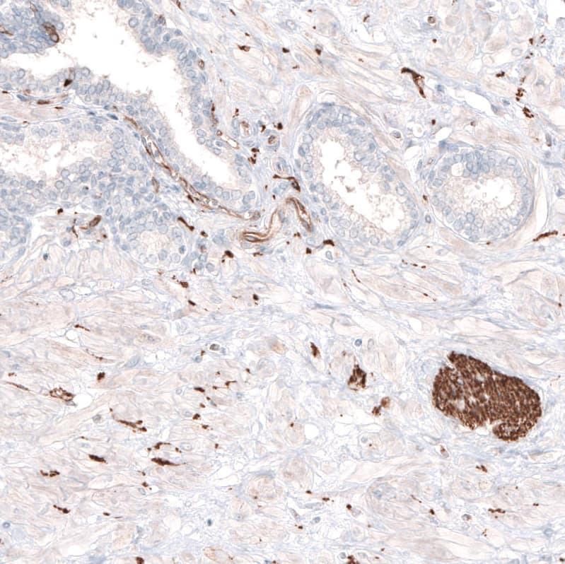 beta-III Tubulin Antibody (CL5813) Immunohistochemistry: beta-III Tubulin Antibody (CL5813) [NBP3-52059]