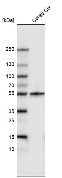 beta-III Tubulin Antibody (CL5813) Western Blot: beta-III Tubulin Antibody (CL5813) [NBP3-52059]