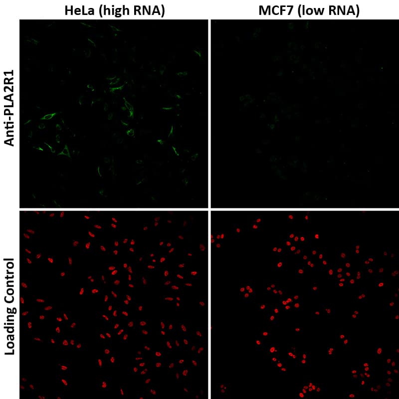 PLA2R1 Antibody (CL0474) Immunocytochemistry/ Immunofluorescence: PLA2R1 Antibody (CL0474) [NBP3-52061]