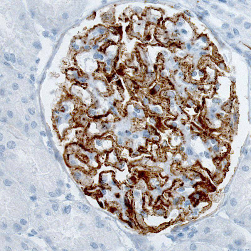 PLA2R1 Antibody (CL0474) Immunohistochemistry: PLA2R1 Antibody (CL0474) [NBP3-52061]