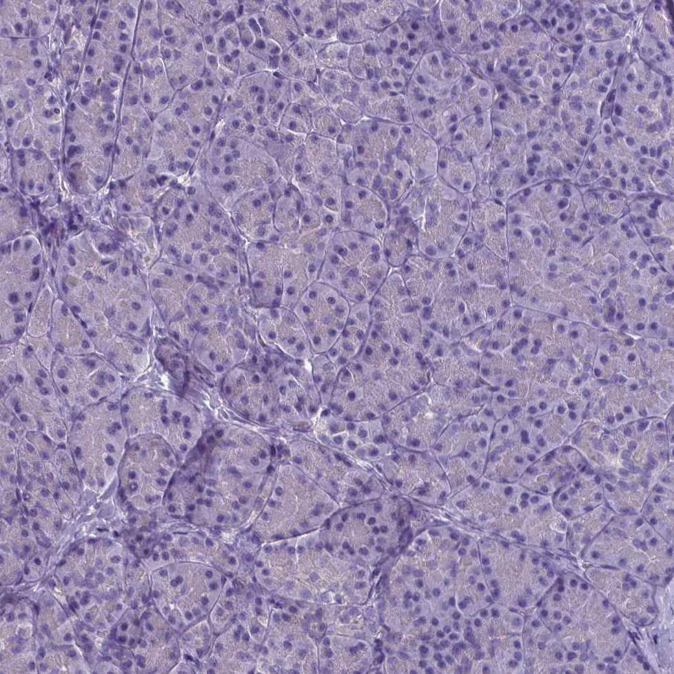 PLA2R1 Antibody (CL0474) Immunohistochemistry: PLA2R1 Antibody (CL0474) [NBP3-52061]