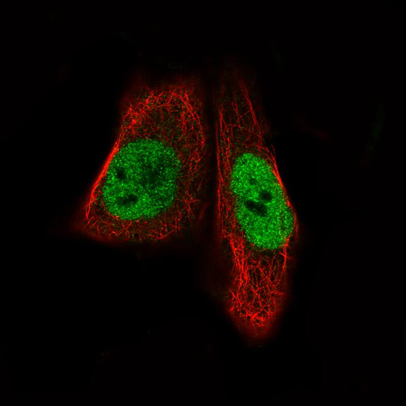 MEF2C Antibody (CL0368) Immunocytochemistry/ Immunofluorescence: MEF2C Antibody (CL0368) [NBP3-52062]