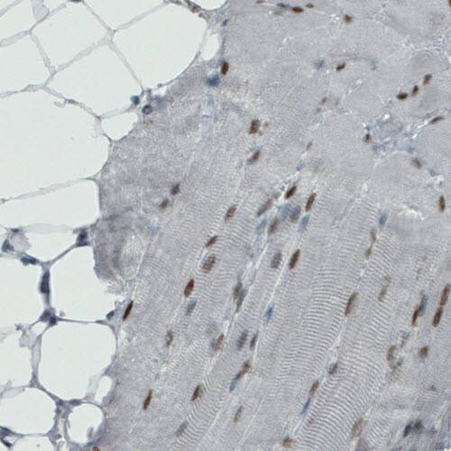 MEF2C Antibody (CL0368) Immunohistochemistry: MEF2C Antibody (CL0368) [NBP3-52062]