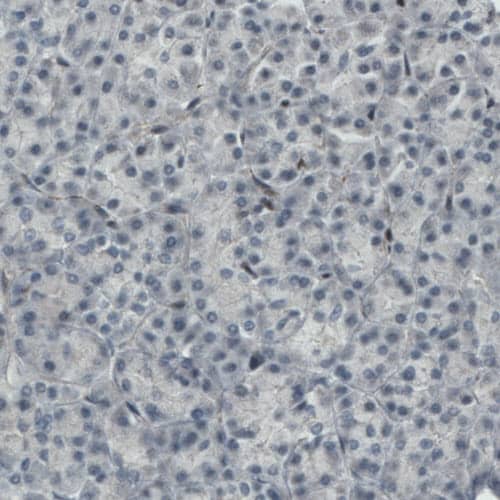 MEF2C Antibody (CL0368) Immunohistochemistry: MEF2C Antibody (CL0368) [NBP3-52062]
