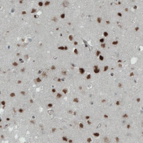 MEF2C Antibody (CL0368) Immunohistochemistry: MEF2C Antibody (CL0368) [NBP3-52062]