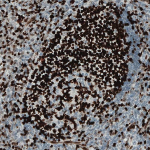 MEF2C Antibody (CL0368) Immunohistochemistry: MEF2C Antibody (CL0368) [NBP3-52062]