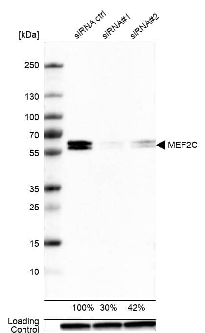 MEF2C Antibody (CL0368) Western Blot: MEF2C Antibody (CL0368) [NBP3-52062]