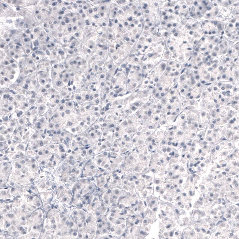 Laminin beta 3 Antibody (CL3353) Immunohistochemistry: Laminin beta 3 Antibody (CL3353) [NBP3-52063]