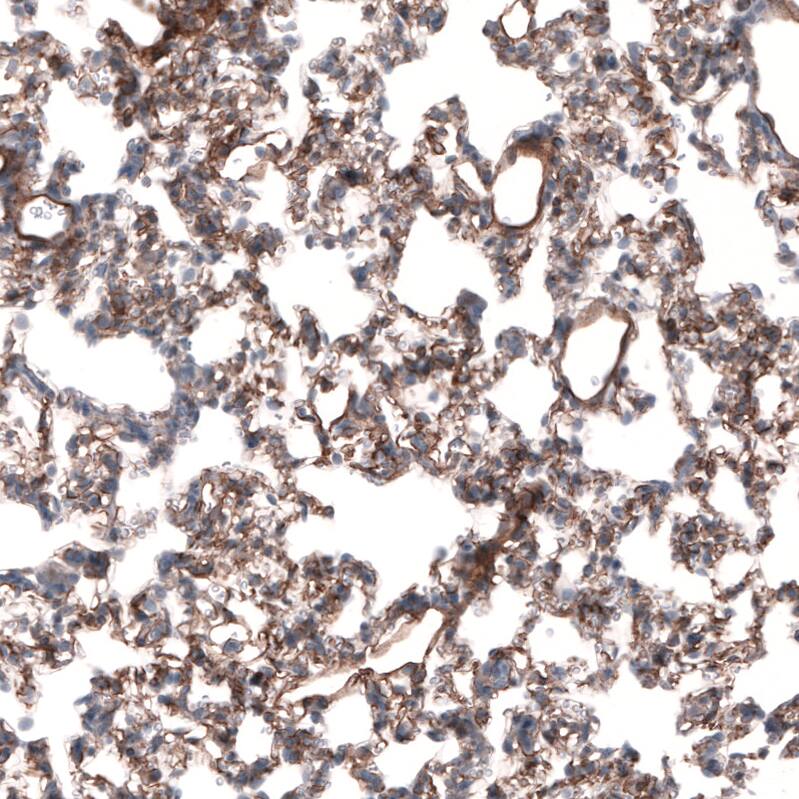 Laminin beta 3 Antibody (CL3353) Immunohistochemistry: Laminin beta 3 Antibody (CL3353) [NBP3-52063]