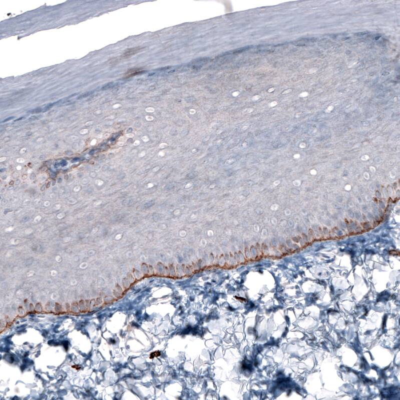 Laminin beta 3 Antibody (CL3353) Immunohistochemistry: Laminin beta 3 Antibody (CL3353) [NBP3-52063]