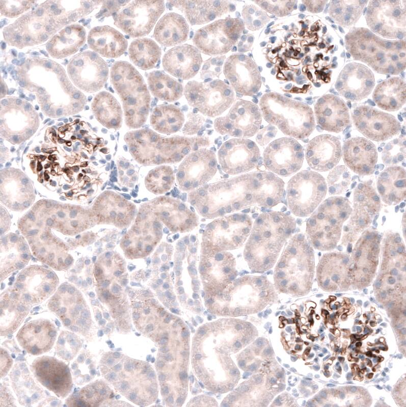 Laminin beta 3 Antibody (CL3353) Immunohistochemistry: Laminin beta 3 Antibody (CL3353) [NBP3-52063]