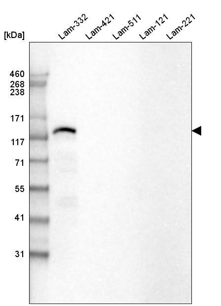 Laminin beta 3 Antibody (CL3353) Western Blot: Laminin beta 3 Antibody (CL3353) [NBP3-52063]