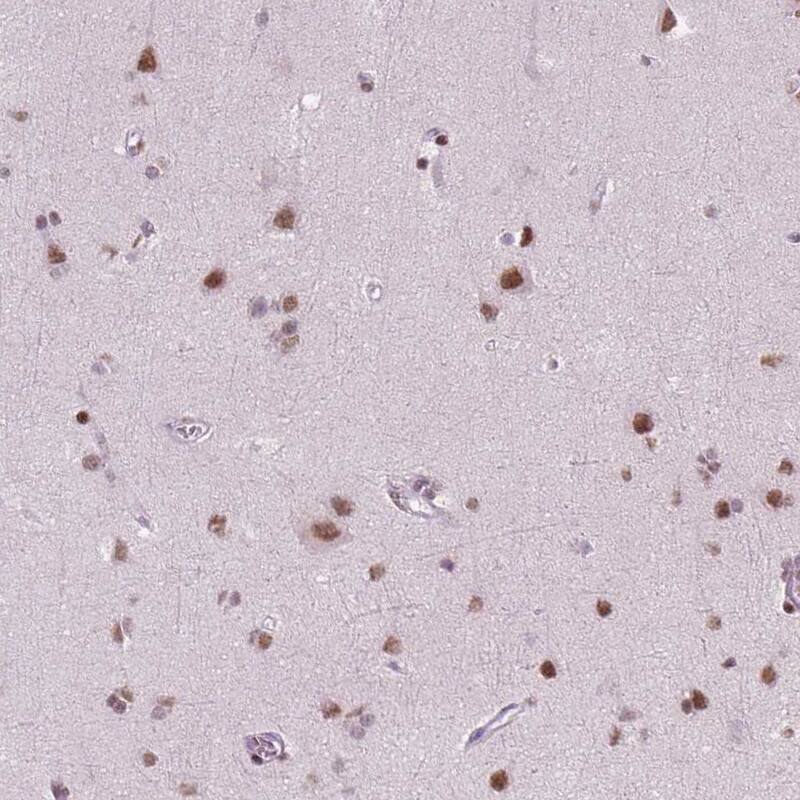 BRD4 Antibody (CL1115) Immunohistochemistry: BRD4 Antibody (CL1115) [NBP3-52453]