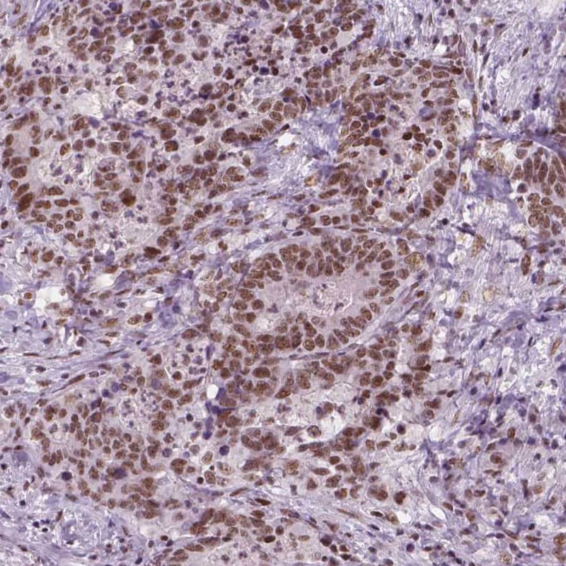 BRD4 Antibody (CL1115) Immunohistochemistry: BRD4 Antibody (CL1115) [NBP3-52064]