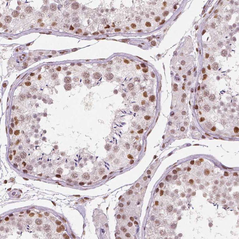 BRD4 Antibody (CL1115) Immunohistochemistry: BRD4 Antibody (CL1115) [NBP3-52064]