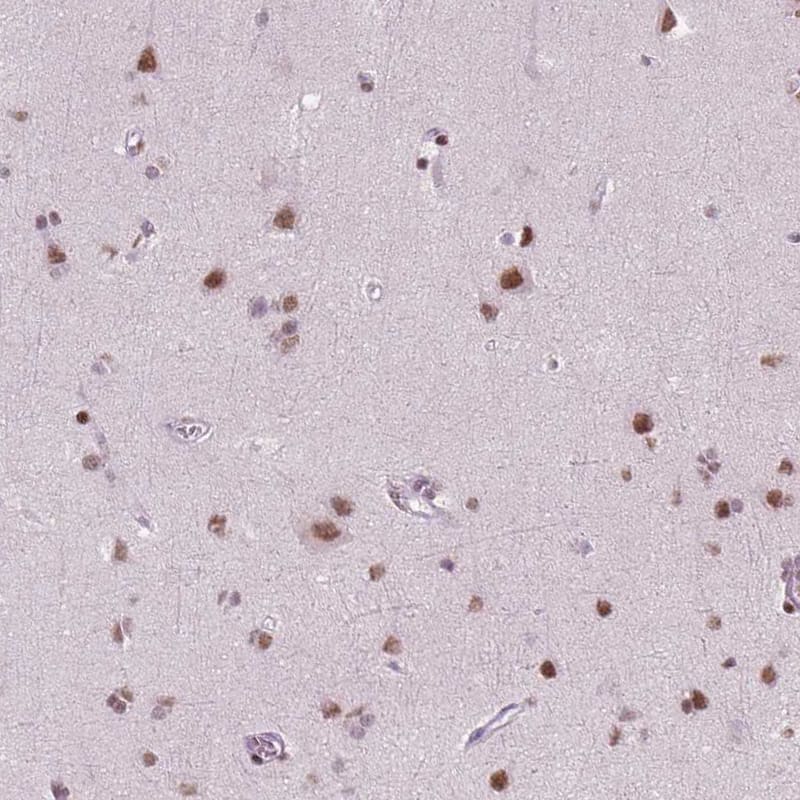 BRD4 Antibody (CL1115) Immunohistochemistry: BRD4 Antibody (CL1115) [NBP3-52064]