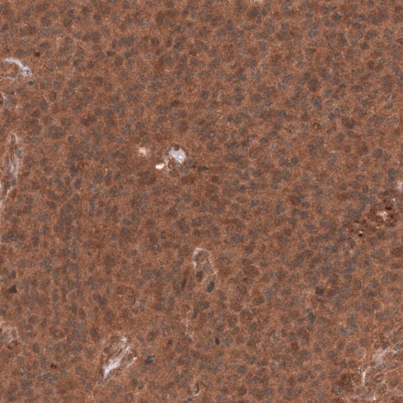 YAP1 Antibody (CL13628) Immunohistochemistry: YAP1 Antibody (CL13628) [NBP3-52066]