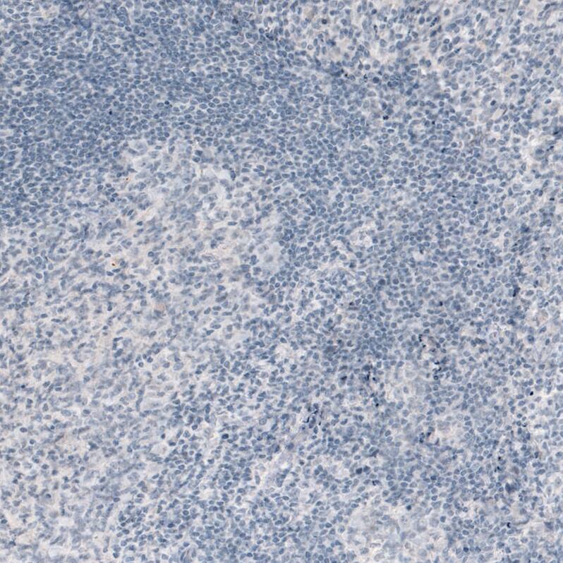 VGLUT2 Antibody (CL2921) Immunohistochemistry: VGLUT2 Antibody (CL2921) [NBP3-52070]
