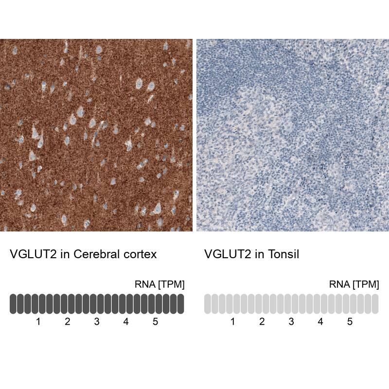 VGLUT2 Antibody (CL2921) Immunohistochemistry: VGLUT2 Antibody (CL2921) [NBP3-52070]