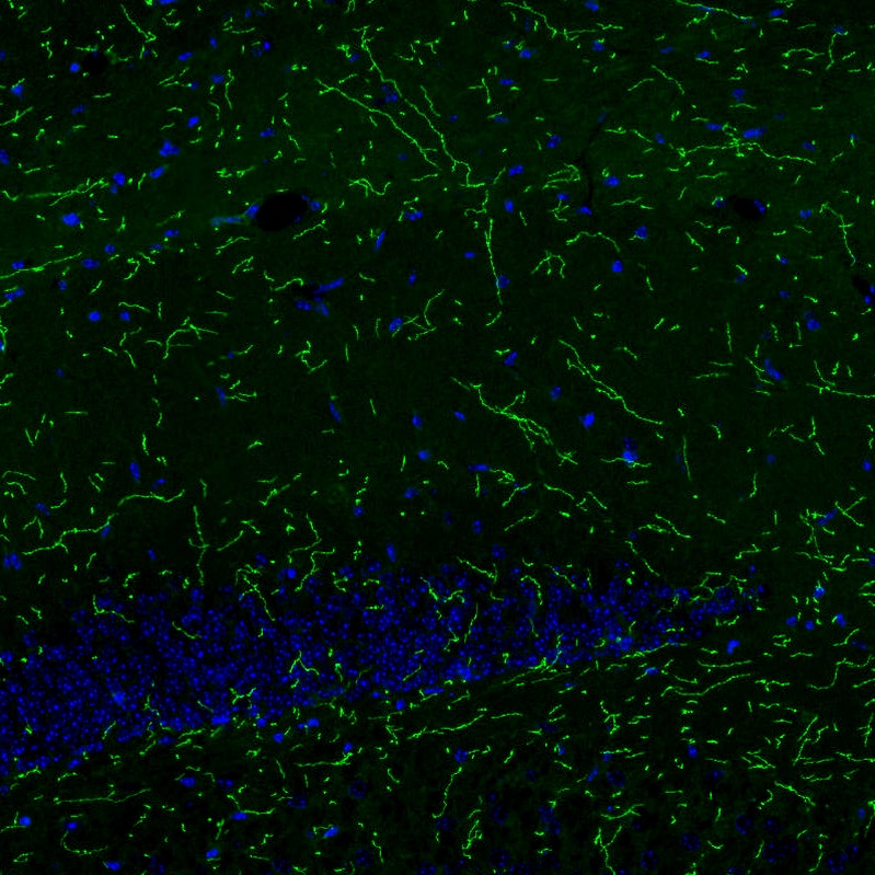 Immunohistochemistry: SLC6A2/NET/Noradrenaline transporter Antibody (CL3063) [NBP3-52071]