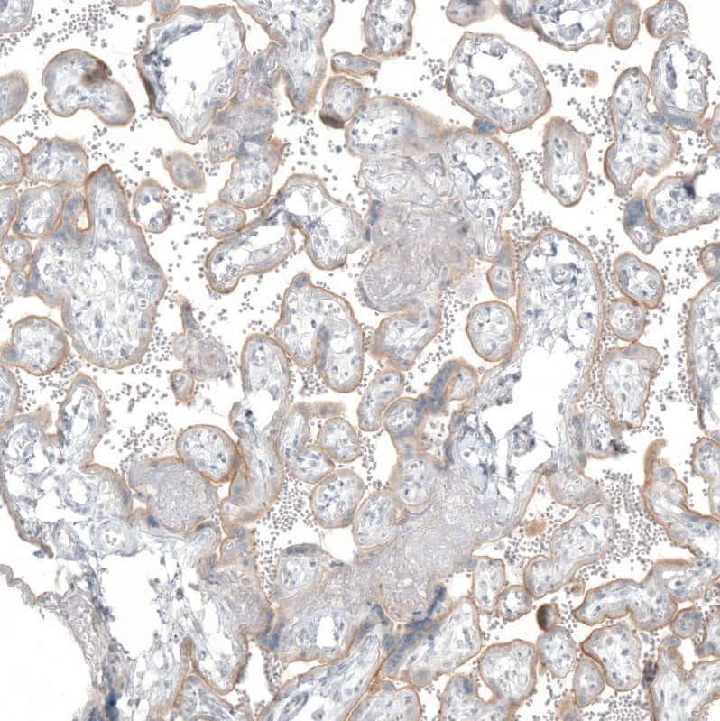 Immunohistochemistry: SLC6A2/NET/Noradrenaline transporter Antibody (CL3063) [NBP3-52071]