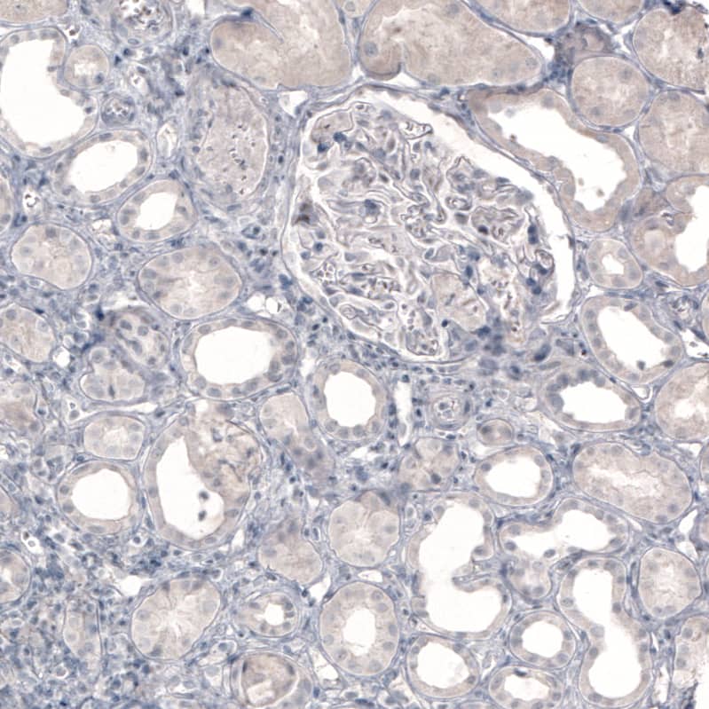 Immunohistochemistry: SLC6A2/NET/Noradrenaline transporter Antibody (CL3063) [NBP3-52071]