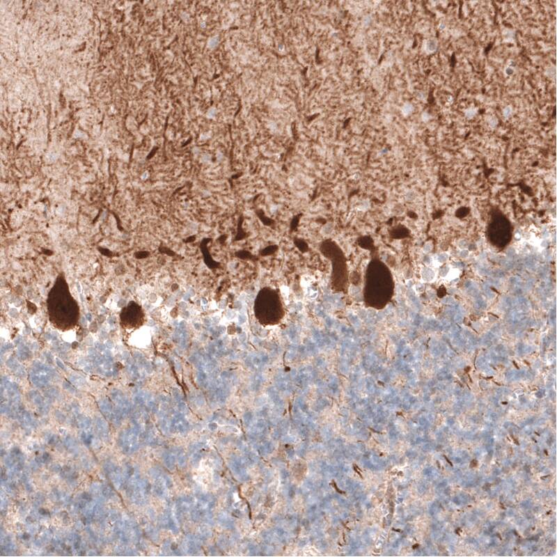 PCP4 Antibody (CL5306) Immunohistochemistry: PCP4 Antibody (CL5306) [NBP3-52072]