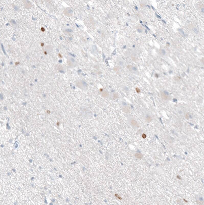 OTP Antibody (CL11222) Immunohistochemistry: OTP Antibody (CL11222) [NBP3-52074]