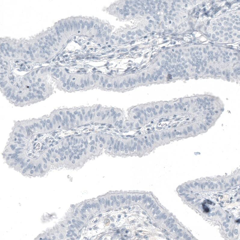 OTP Antibody (CL11222) Immunohistochemistry: OTP Antibody (CL11222) [NBP3-52074]