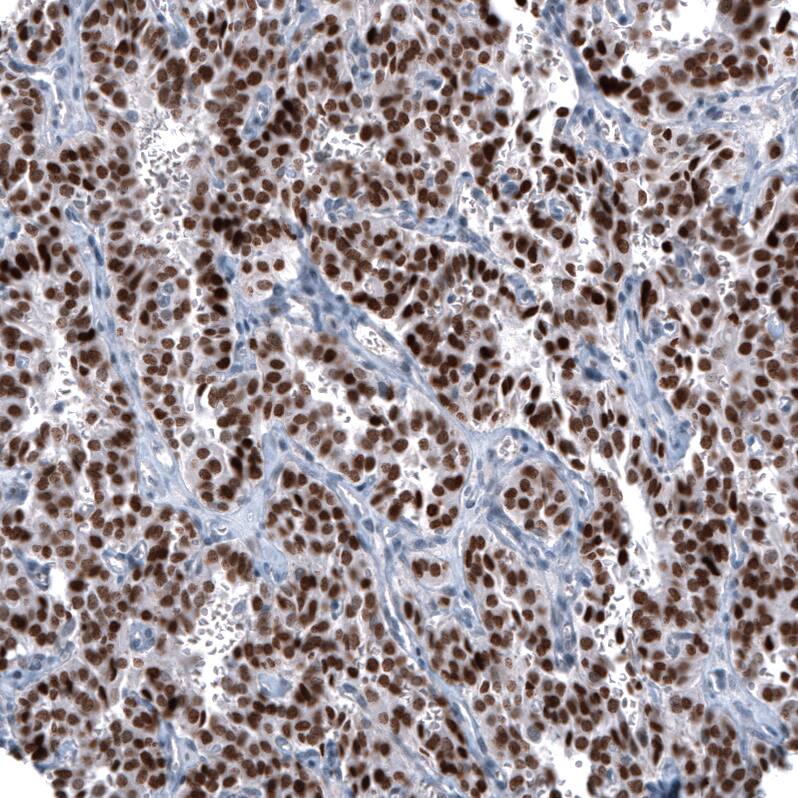 OTP Antibody (CL11222) Immunohistochemistry: OTP Antibody (CL11222) [NBP3-52074]